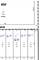 Vacant Lot W Gail, Monee, IL 60449
